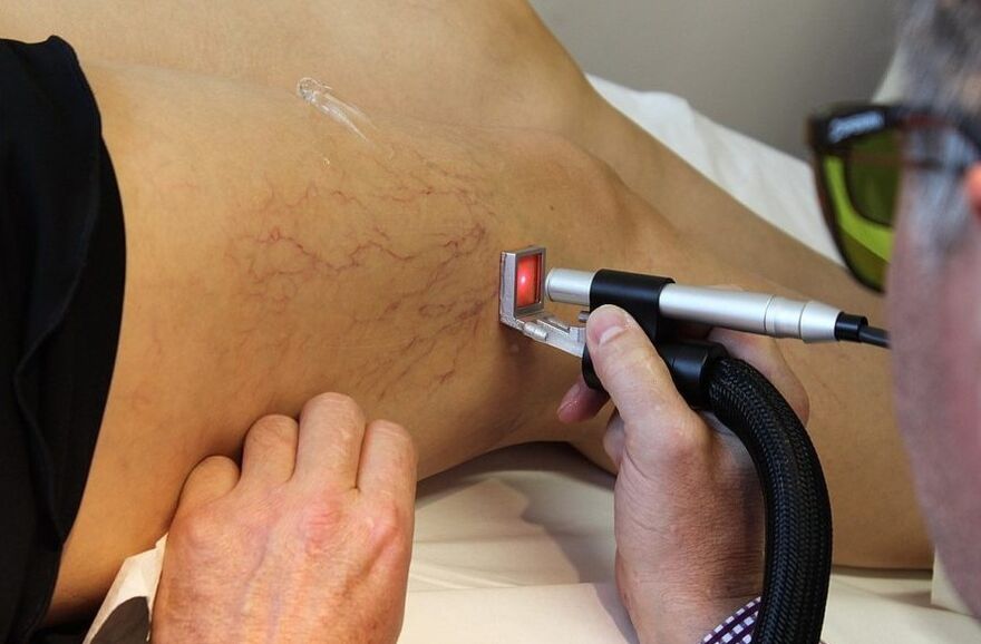 Laserstrahlung